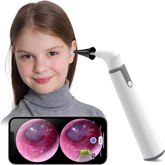 Ear Camera Endoscope 3.9mm - Digital Ear Inspector Compatible with Android and iPhone