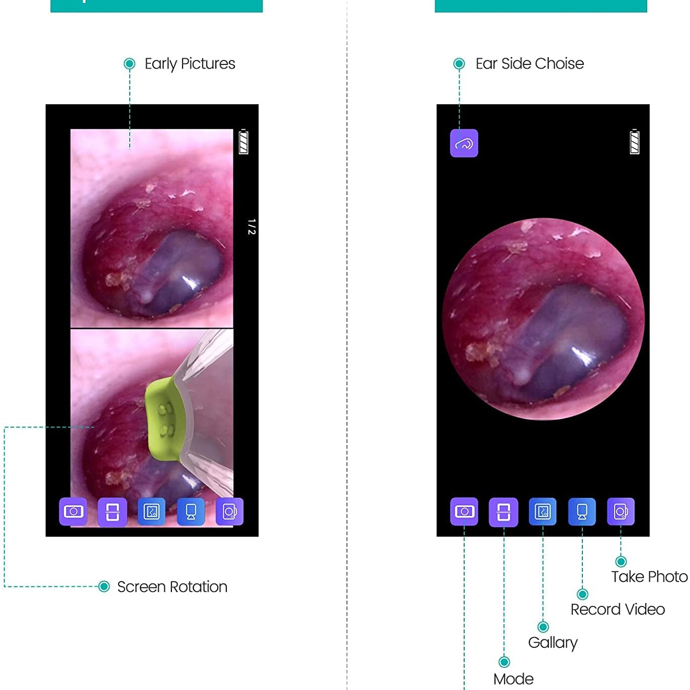 Ear Camera Endoscope 3.9mm - Digital Ear Inspector Compatible with Android and iPhone